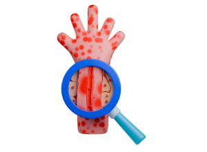 Immunthrombozytopenie (ITP): Wie wird die Diagnose gestellt?