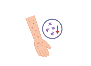 Immunthrombozytopenie (ITP): Symptome, Diagnose und Behandlungsmöglichkeiten